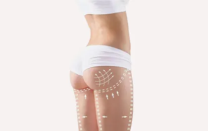 Preoblikovanje telesa z ultra shaper metodo - izboljšanje tonusa