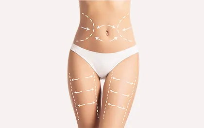 Preoblikovanje telesa z ultra shaper metodo