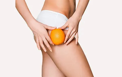 Preoblikovanje telesa z ultra shaper metodo - zmanjšanje celulita